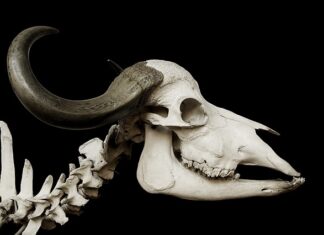 Czy po radioterapii mogą boleć kości? Czy po radioterapii mogą boleć kości?